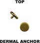 Top for dermal anchor 18041